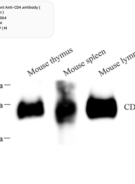 Servicebio 重组抗CD4抗体（兔单抗）,Anti-CD4，GB15064，100μL