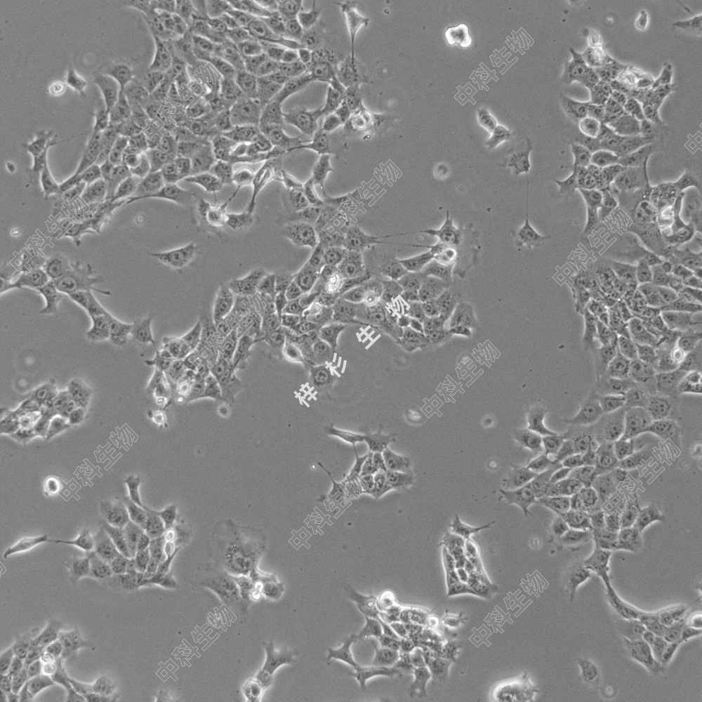 小鼠乳腺癌细胞(4T1)培养基套装 STR鉴定正确4T1-LUC标签细胞科研