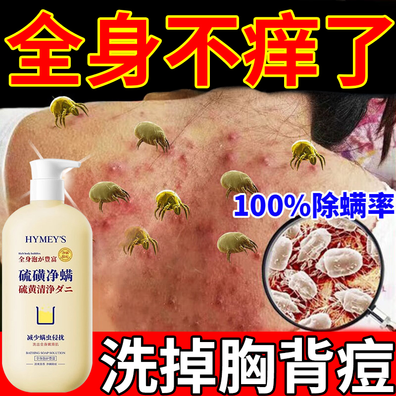 硫磺除螨沐浴露皮肤瘙痒祛后背痘清洁红点止痒去螨虫液体留香持久