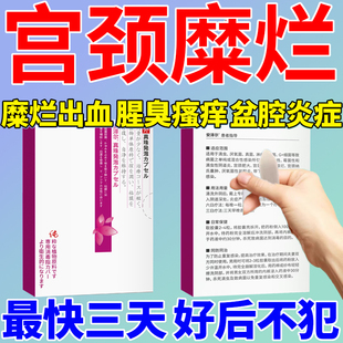 雌三醇欧维婷软膏乳膏天然更年期外用妇科激素雌植物如