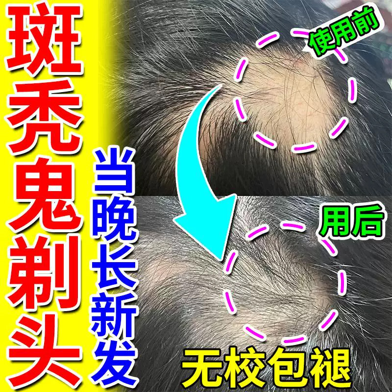 益肾生发丸北京同仁堂乌发口服液治疗女性脱发补肾生发液治疗白发