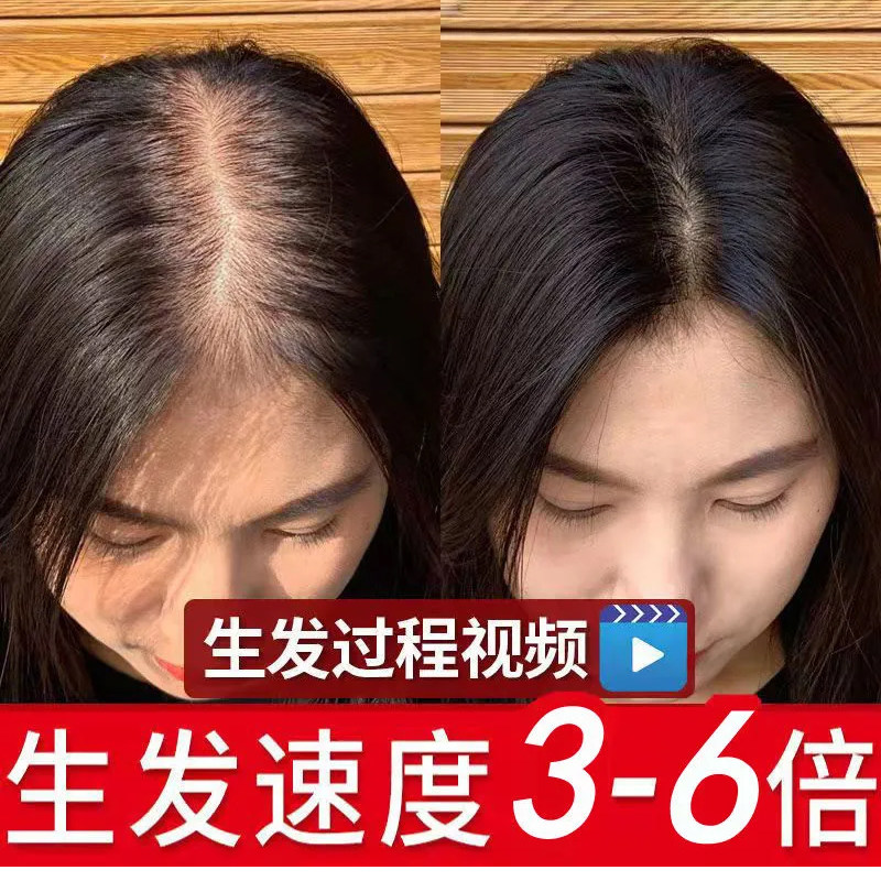 同仁堂乌发丸北京同仁堂防衰益寿丸益肾补精补肾养血乌发丸御品