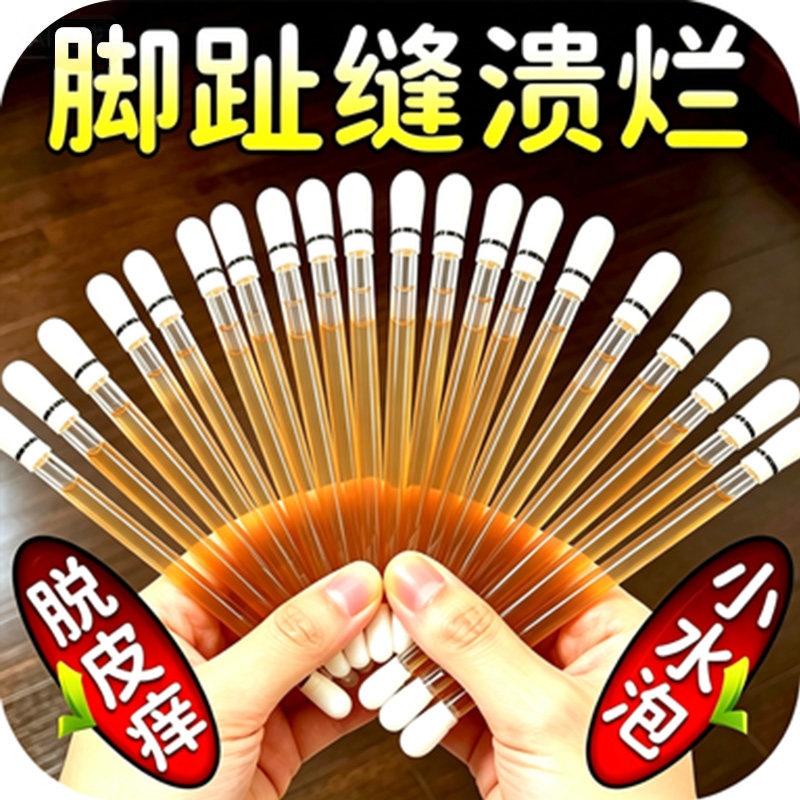 脚趾溃烂脚丫脚痒糜烂水泡真菌脚汗脱皮感染脚臭杀菌棉签