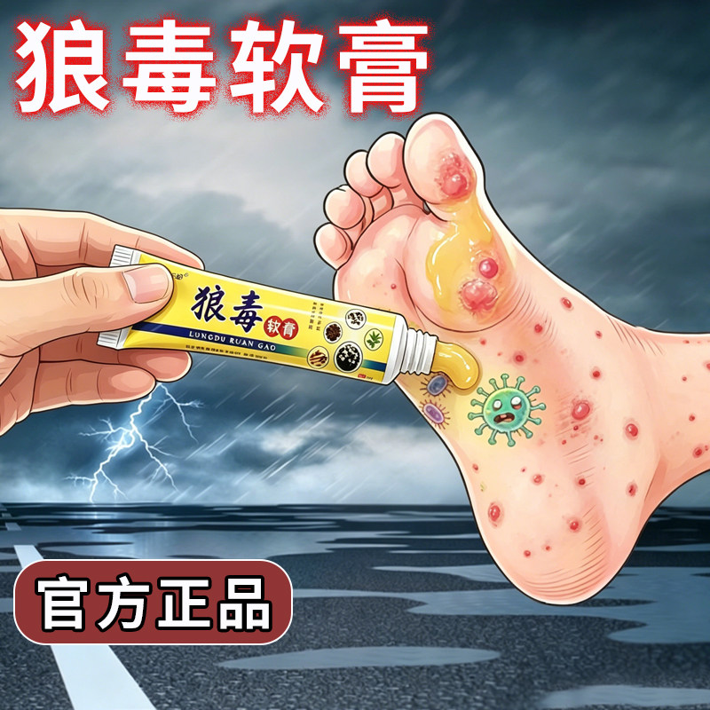 狼毒脚痒手部水泡脱皮烂脚丫脚臭除臭脚汗膏去痒乳膏