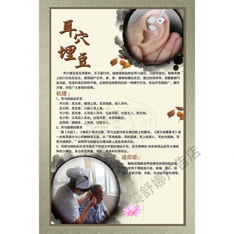 耳穴埋豆养生疗法好处功效适应症人群宣传广告贴纸装饰画挂图海报