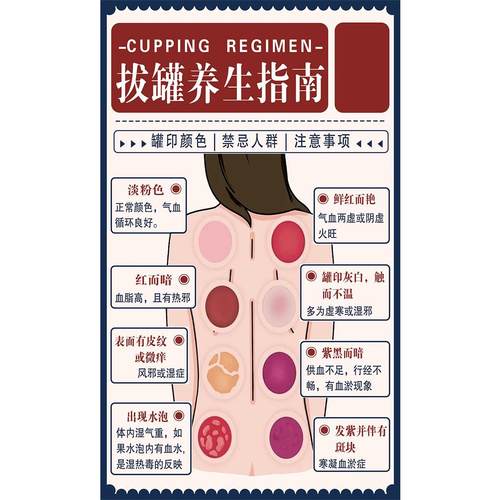 拔罐颜色辩健康海报中医调理美容院养生馆装饰图墙贴广告画