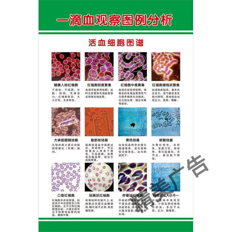 一滴血观察图例分析活血细胞图谱海报KT板展板墙贴纸