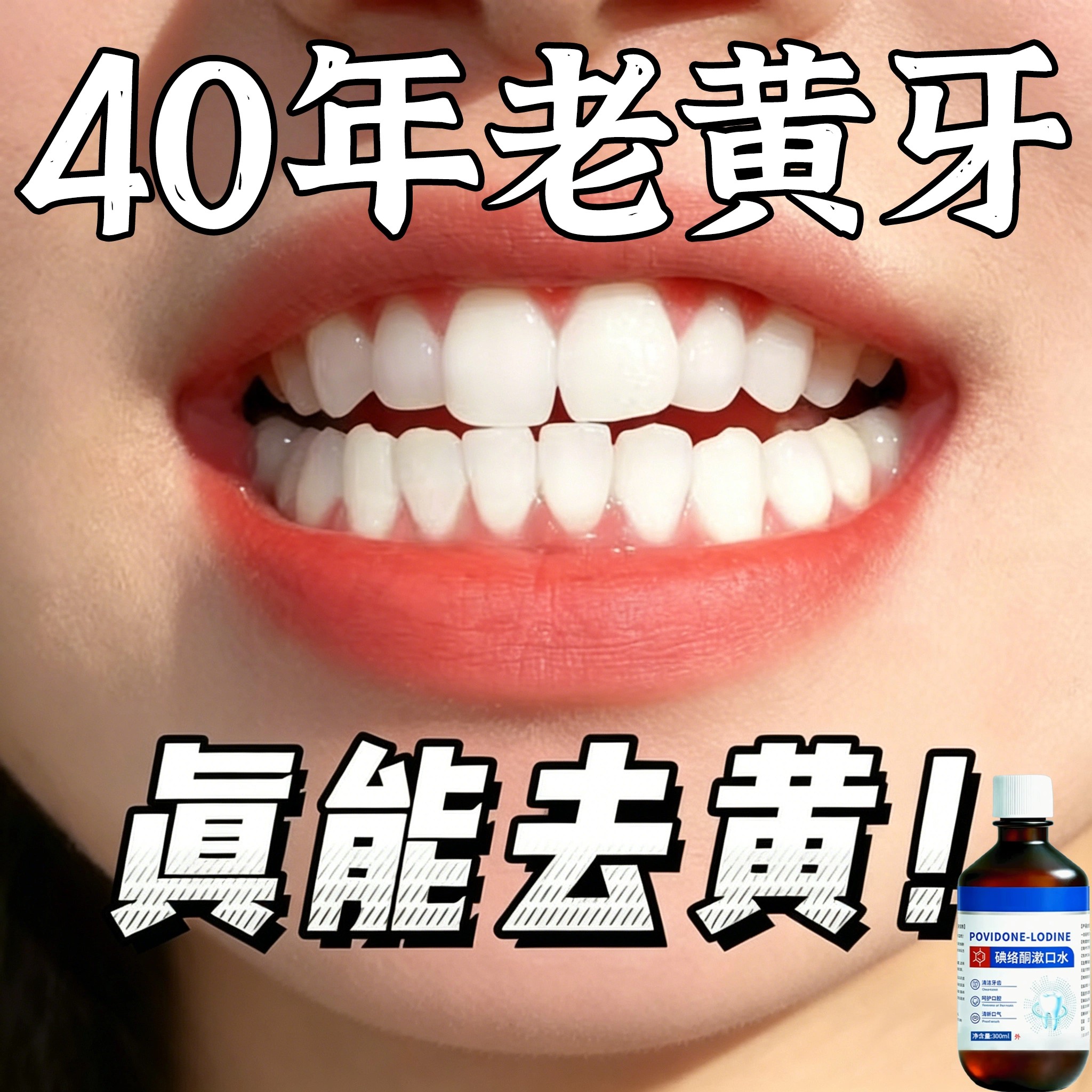 【重度牙结石】牙黄牙石溶解漱口水洗牙齿污垢牙垢牙黄牙渍清理
