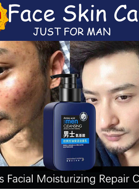 男士洗面奶Men Acne Face Wash cleanser acne blackhead remove