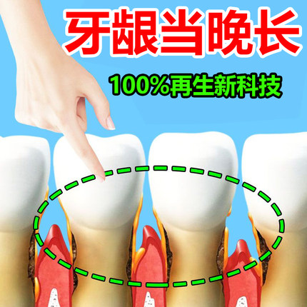 治牙龈萎缩修复再生疗牙根外露特效药黑三角牙齿松动专用牙膏医用
