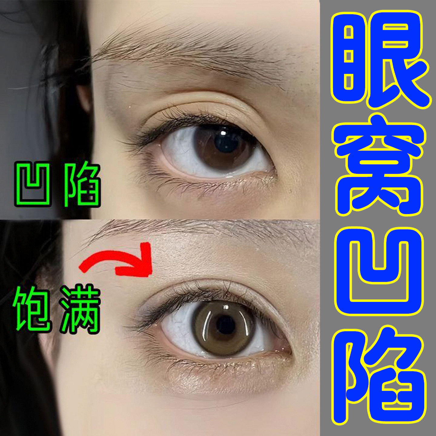 眼窝凹陷提拉紧致眼皮松弛眼肌无力睁不开眼睛眼睑下垂松弛眼膏