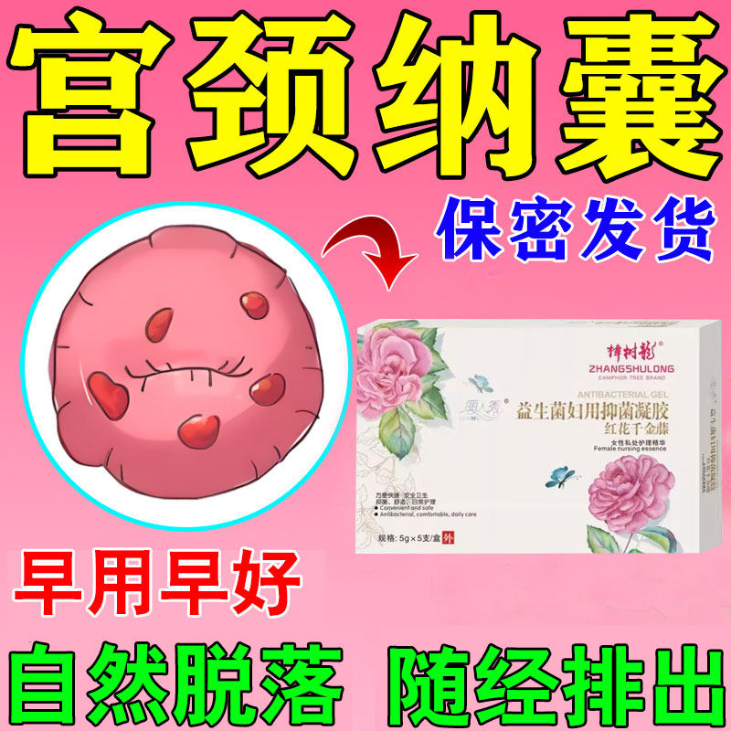 宫颈纳氏囊肿药治疗妇科炎症豆腐渣白带宫颈糜烂肥大中药妇科凝胶