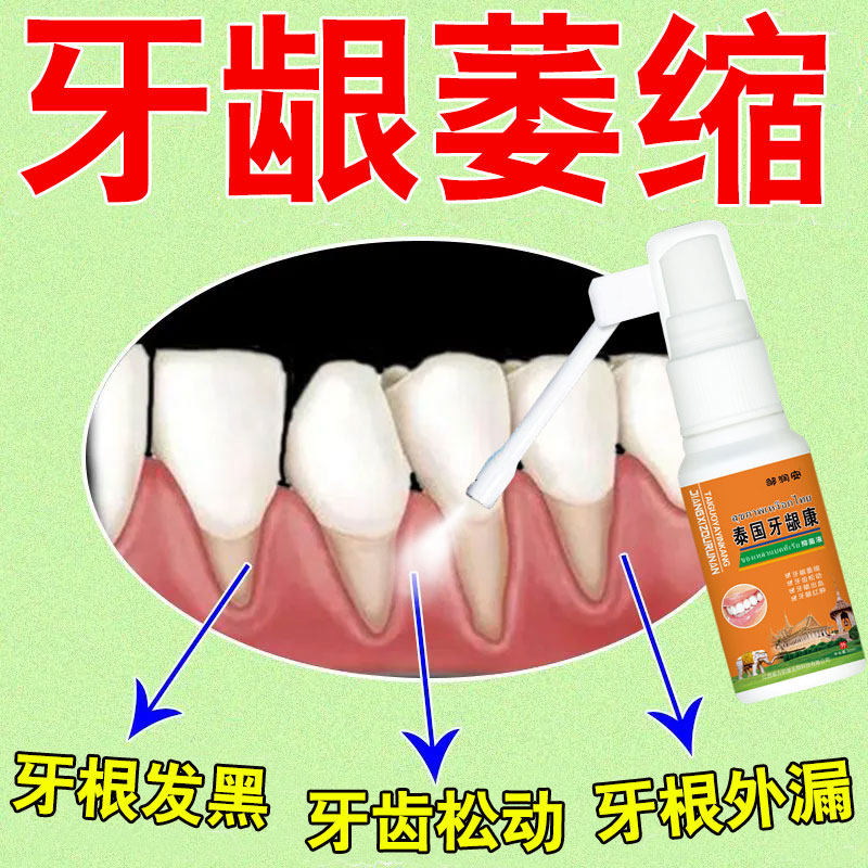 牙龈萎缩修复再生喷剂牙根外露黑三角固齿防牙根牙龈肿胀中药喷剂