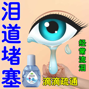 泪道堵塞眼药水眼睛老是流泪泪腺囊炎疏通缓解眼疲劳干涩发痒模糊
