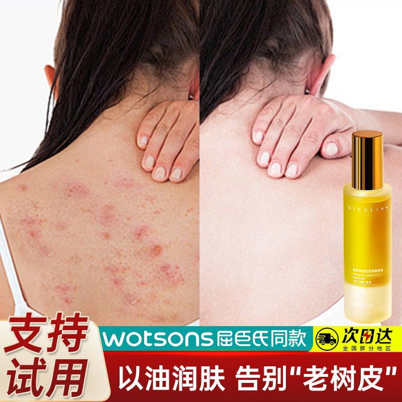 身体乳精油护肤油喷雾补水保湿滋润秋冬干燥止痒甘油润肤油旗舰店