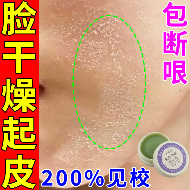脸上干燥起皮皮肤修复脸部泛红痒脱皮过敏长癣有碎屑爆皮滋润保湿