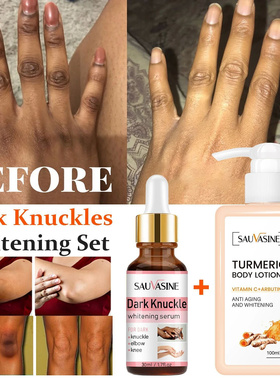 2pcs Dark Knuckle Whitening Serum Turmeric Body Lotion Remov