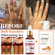 Dark Lotion Knuckle Serum 2pcs Body Whitening Turmeric Remov