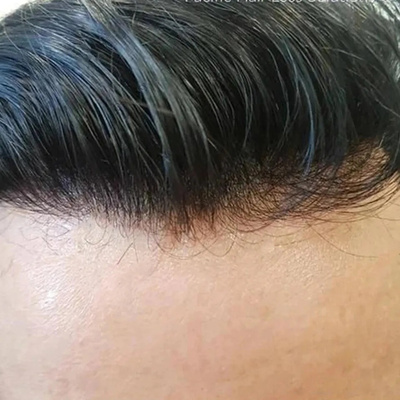 Natural Hairline Toupee Thin Skin Wig Full PU 男士补发块