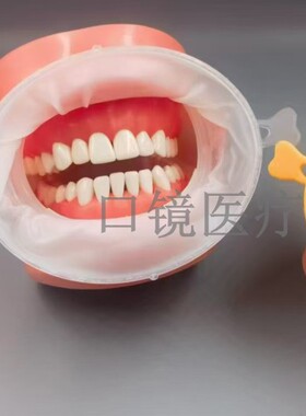 牙科橡皮障O型开口器橡胶开口器蓝色白色橙色 口腔橡扩口器