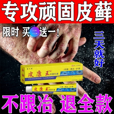 治疗顽固牛皮癣藓鲜银屑病体股藓手癣湿疹非皮肤病特效药专用药膏