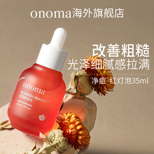 奥浓漫红灯泡舒润精华液粉刺痤疮瑕疵肌肤控油 Onoma 清仓特惠