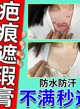 凹凸疤痕遮盖神器手术疤痕脖子腋下手臂疤痕遮瑕膏纹身胎记淡化液