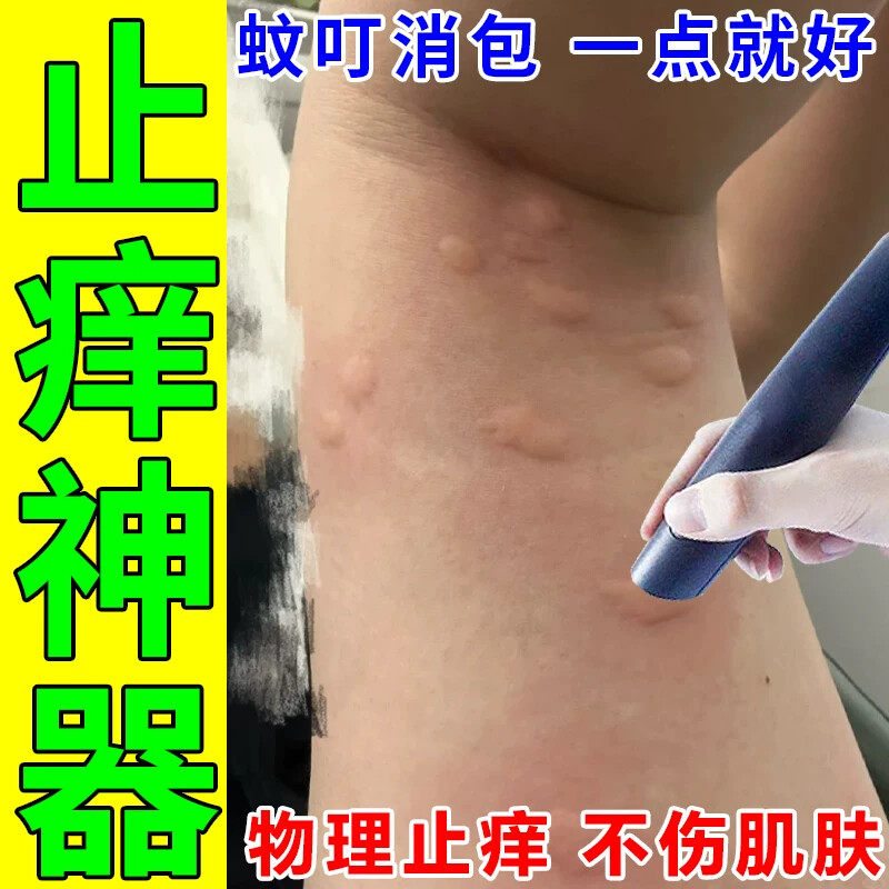 止痒笔物理止痒蚊虫叮咬止痒笔电子防蚊叮咬快速止痒消肿止痒神器
