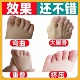 儿童小孩小儿脚趾矫正器纠正神器重叠大母脚趾外翻叠趾固定分趾器