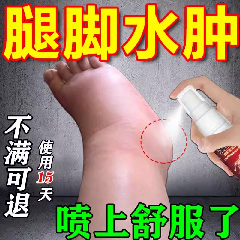 老人脚肿否去水肿专用的药下肢腿部水肿特浮肿利尿排水效神器