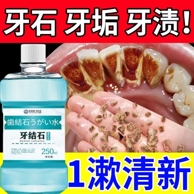 日本牙垢牙结石清除神器漱口水速效溶解清理杀菌除口臭牙污垢牙黄