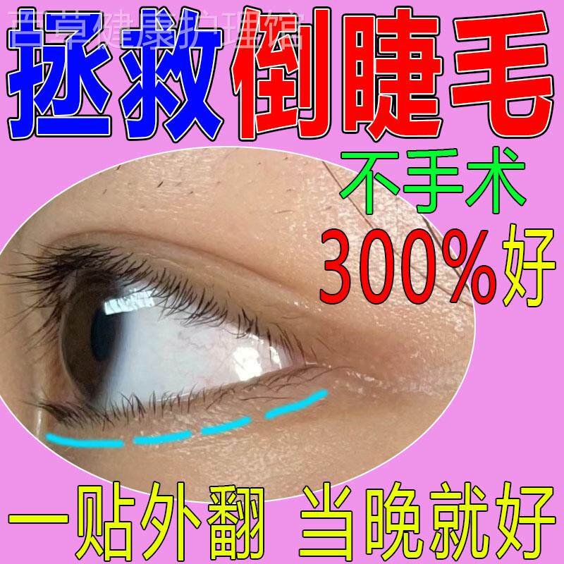 倒睫毛矫正专用贴成人儿童上眼睑下垂外翻提拉下睫毛倒睫医用眼贴