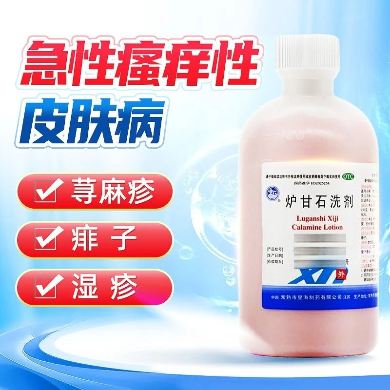 【星海】炉甘石洗剂100ml*1瓶/盒湿疹荨麻疹痱子皮肤瘙痒瘙痒