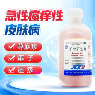 星海 炉甘石洗剂 100ml成人急性瘙痒性皮肤病荨麻疹宝宝儿童痱子