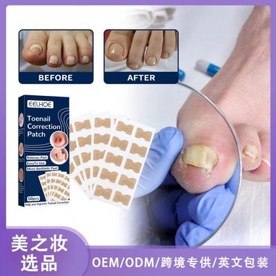 EELHOE Toenail Correction Stickers, Nail Correction Adhesive