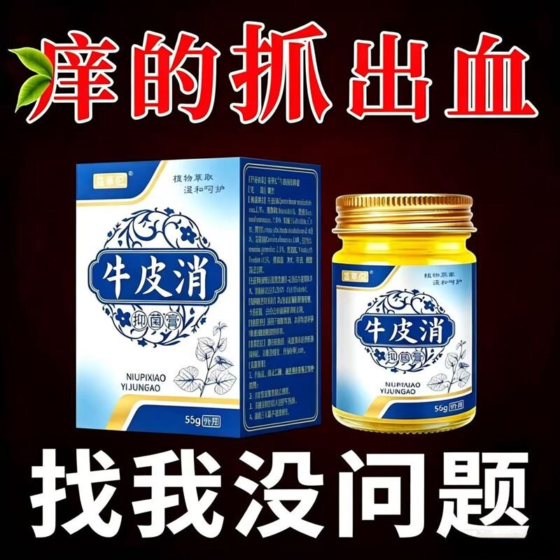 正品牛皮消牛皮屑癣脂溢皮性炎真感菌染银止炎抑去皮痒癣菌软膏股