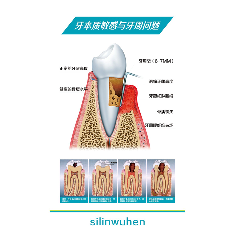 牙齿结构图牙齿疾病构造成人牙列知识口腔保健医院装饰画海报贴画