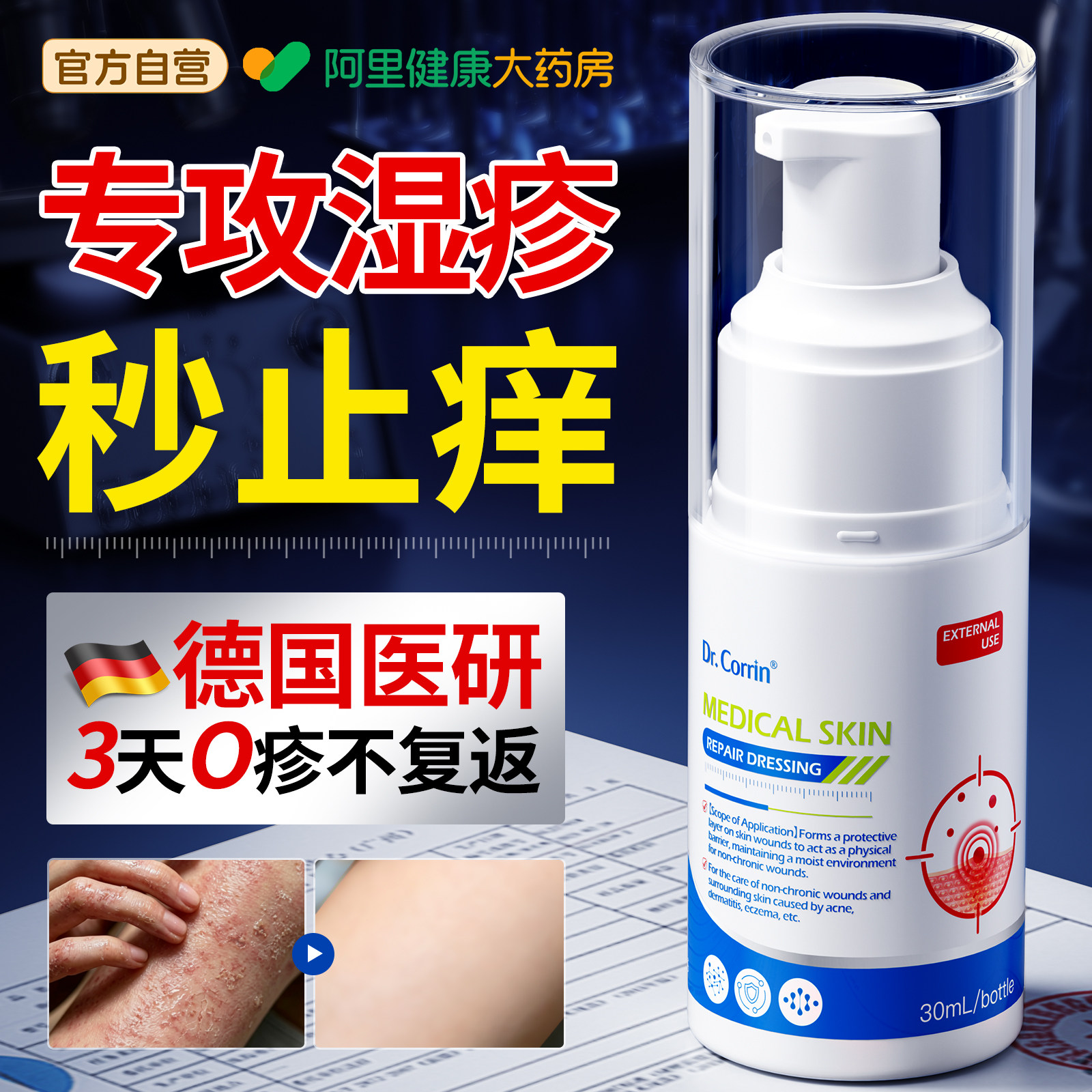 德国医用级丨秒止痒强效断湿疹图片