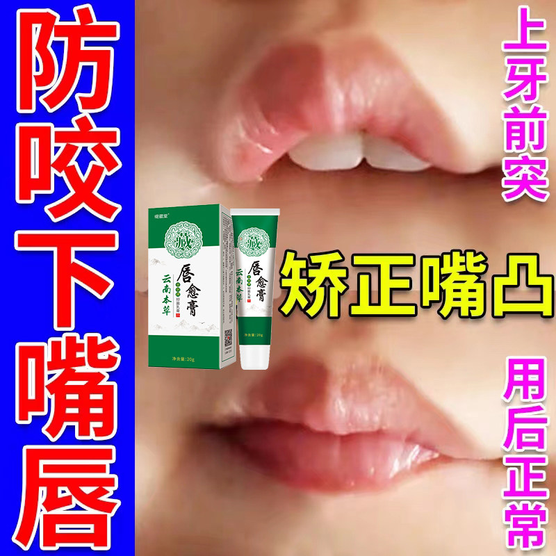 儿童戒咬嘴唇矫正宝宝防咬下嘴唇肌神器纠正小孩子咬嘴前庭盾嘴突