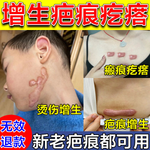 疤痕增生凸起去除疙瘩手术祛疤膏祛胸前瘢痕剖腹产修复凝胶软化针