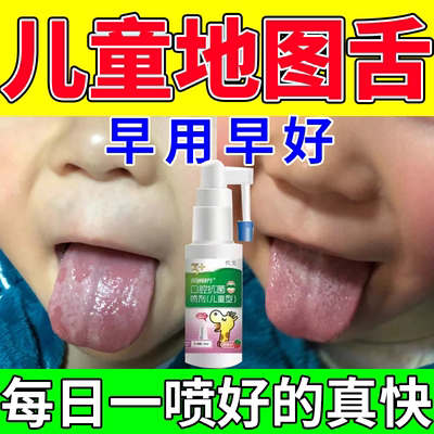 地图舌调理儿童舌炎喷雾舌头溃疡口腔黏膜修复液舌头中间有裂纹CJ