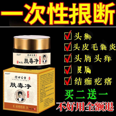 【包冶好】头皮屑治顽固头藓脂溢性皮炎真菌感染膏头痒毛囊炎专用
