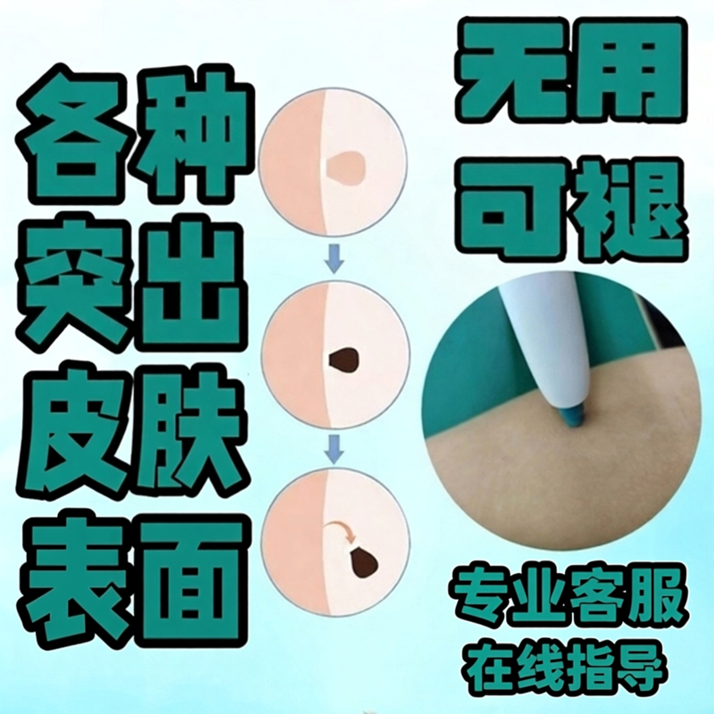 皮赘去除神器各种脖子腋下尤猴子肉粒疙瘩肉球物理无痕祛除工具