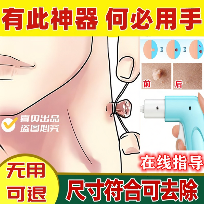 皮赘去除神器去小肉粒肉瘤揪肉球勒耳洞增生祛除工具