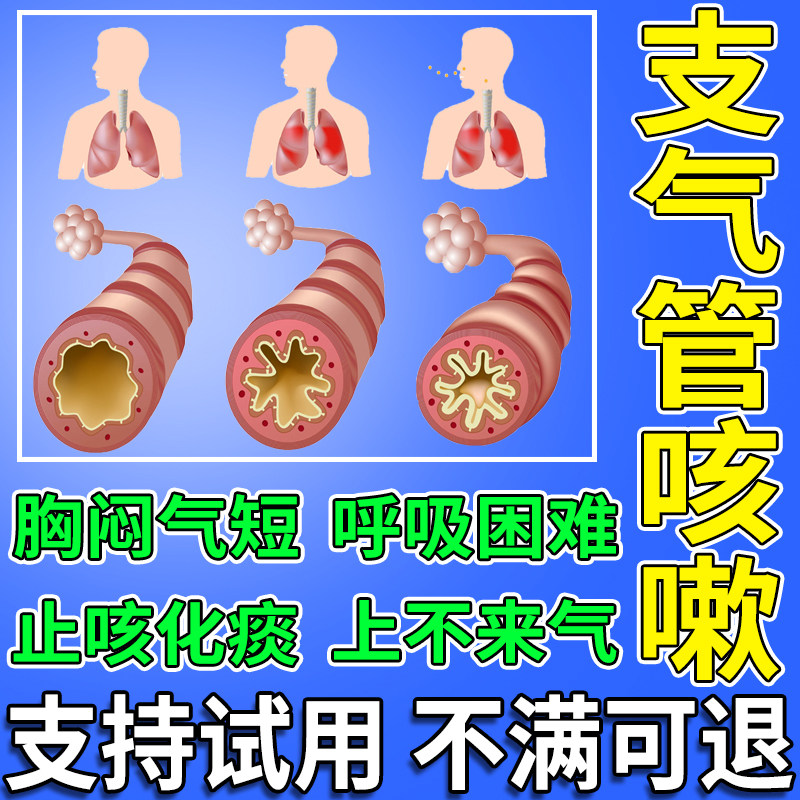 支气管炎扩张贴慢性咳嗽过敏性哮喘止咳化痰润肺儿童中y磁疗贴