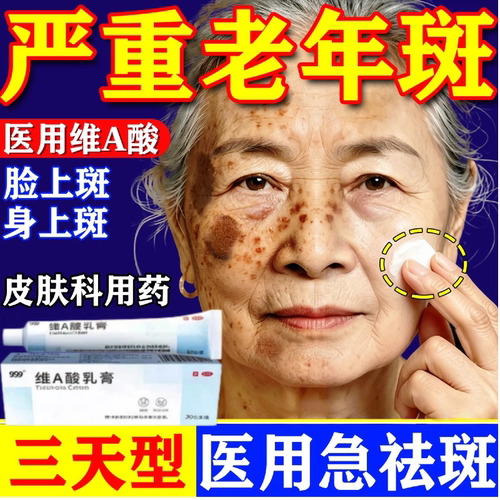 [999]维A酸乳膏0.025%*30g*1支/盒