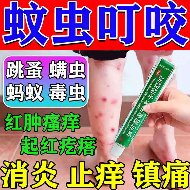 林可霉素利多卡因凝胶蚊虫叮咬快速止痒消肿儿童专用止痒膏创伤QX