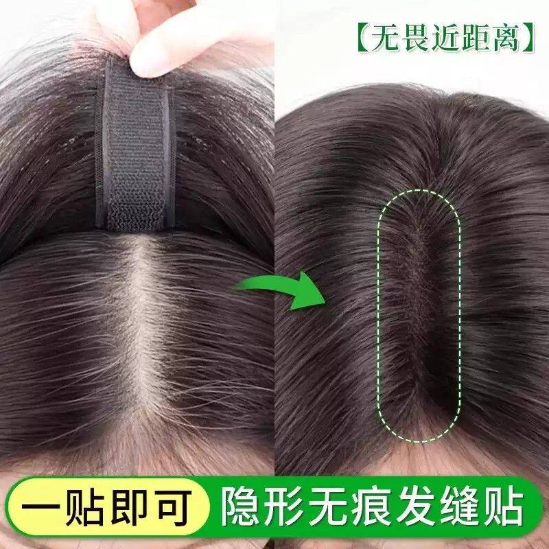假发女片头顶遮发缝贴仿真轻薄无痕高颅顶补发增发量发际线假发贴