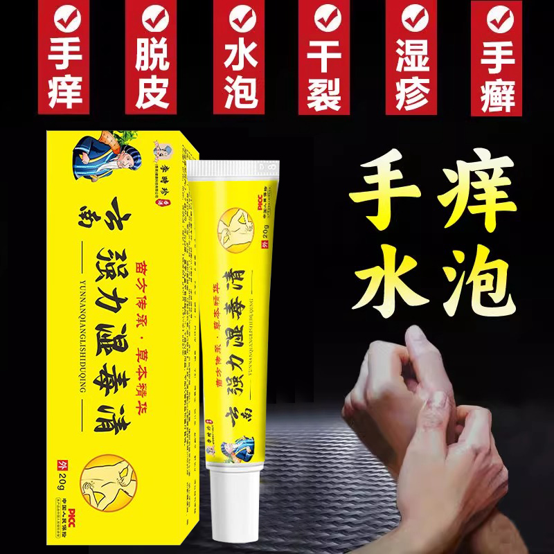 手上起小水泡孢疹软膏汗泡疱疹药膏汗状止痒型真菌感染汗泡疹克星