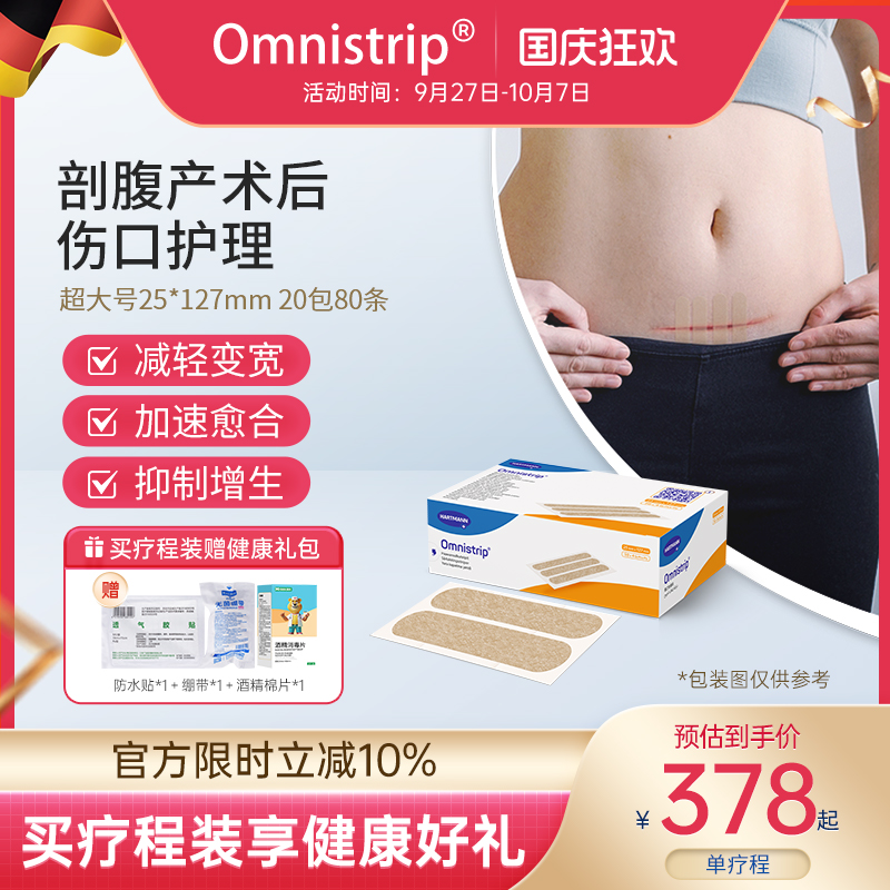德国Omnistrip张贴免缝胶带